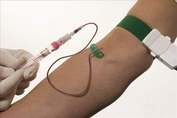 哪些人应该定期做血液肿瘤标志物检查,报告单