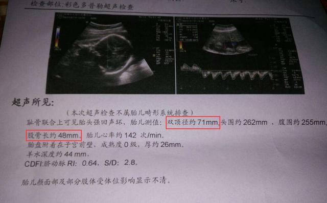 孕检时,如果有这4种情况,那说明怀男宝的几率很高哦