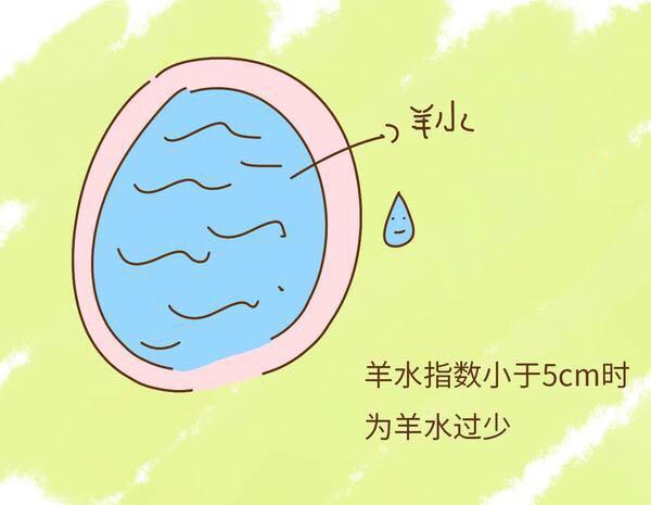羊水偏少的几大原因,孕妈们要知道!