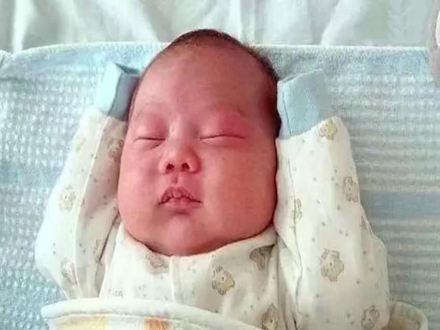 刚出生的宝宝四肢异常肿胀,医生打开包裹一看