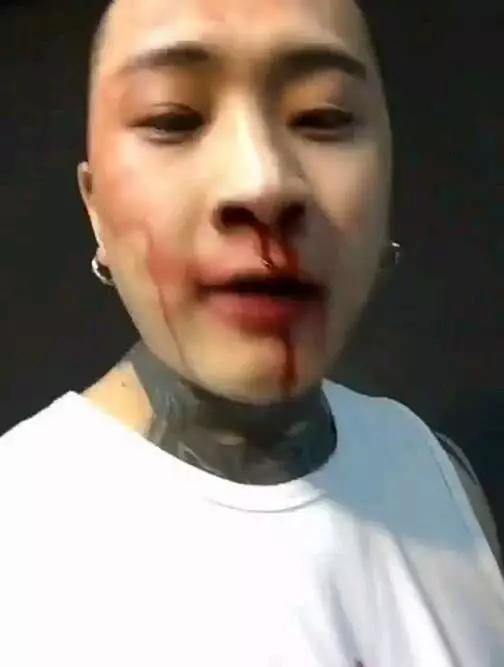 快手大整顿,为什么这个网黑没有被制裁?