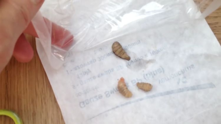 女子半夜被手臂疼醒,去医院检查,医生取出的异