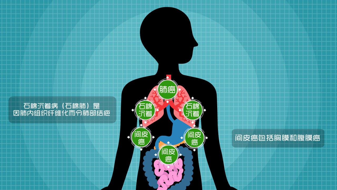 3D:用爽身粉30年患癌?男子告赢强生将获赔2.3亿