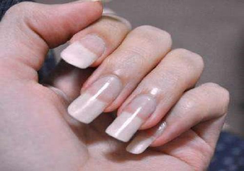 得了灰指甲用什么药?推荐几款治疗灰指甲的药