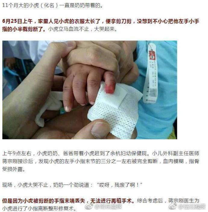 衣服太长拿剪刀剪,杭州11个月宝宝竟被家人剪断手指,断指还丢了