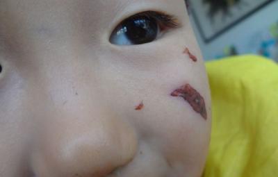 7个月宝宝疯狂扣眼,粗心妈妈没在意,知道病因