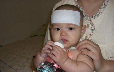 因为妈妈的疏忽, 让异物卡在宝宝肺中呆了3年