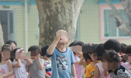 4岁孩子吃完饭打个喷嚏,碗里桌上全是血,最近