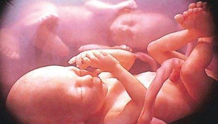 准妈妈注意了, 孕晚期出现这几件事, 容易导致胎