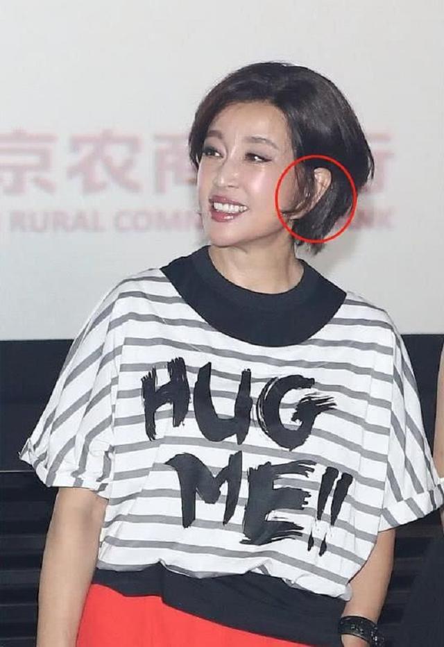 63岁高龄少女刘晓庆,为青春拉皮拉到耳朵变形?