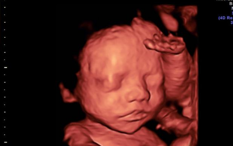 怀孕24周去医院做四维,医生看到宝宝表情后,痛骂孕妈不自爱