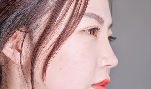 身上发痒是什么原因 三种原因导致身上痒