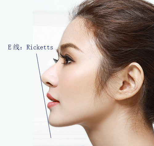 凸=土?凸嘴分3级,你是哪一级?