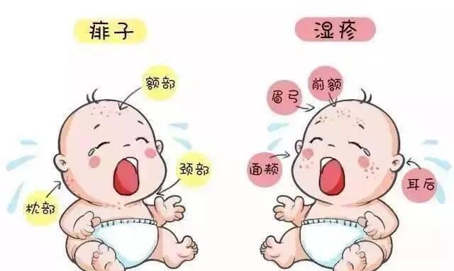 湿疹和热痱子的区别图片