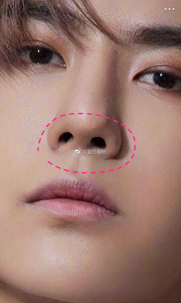 王一博整容后遗症出现了?他的近照已经崩了,缩