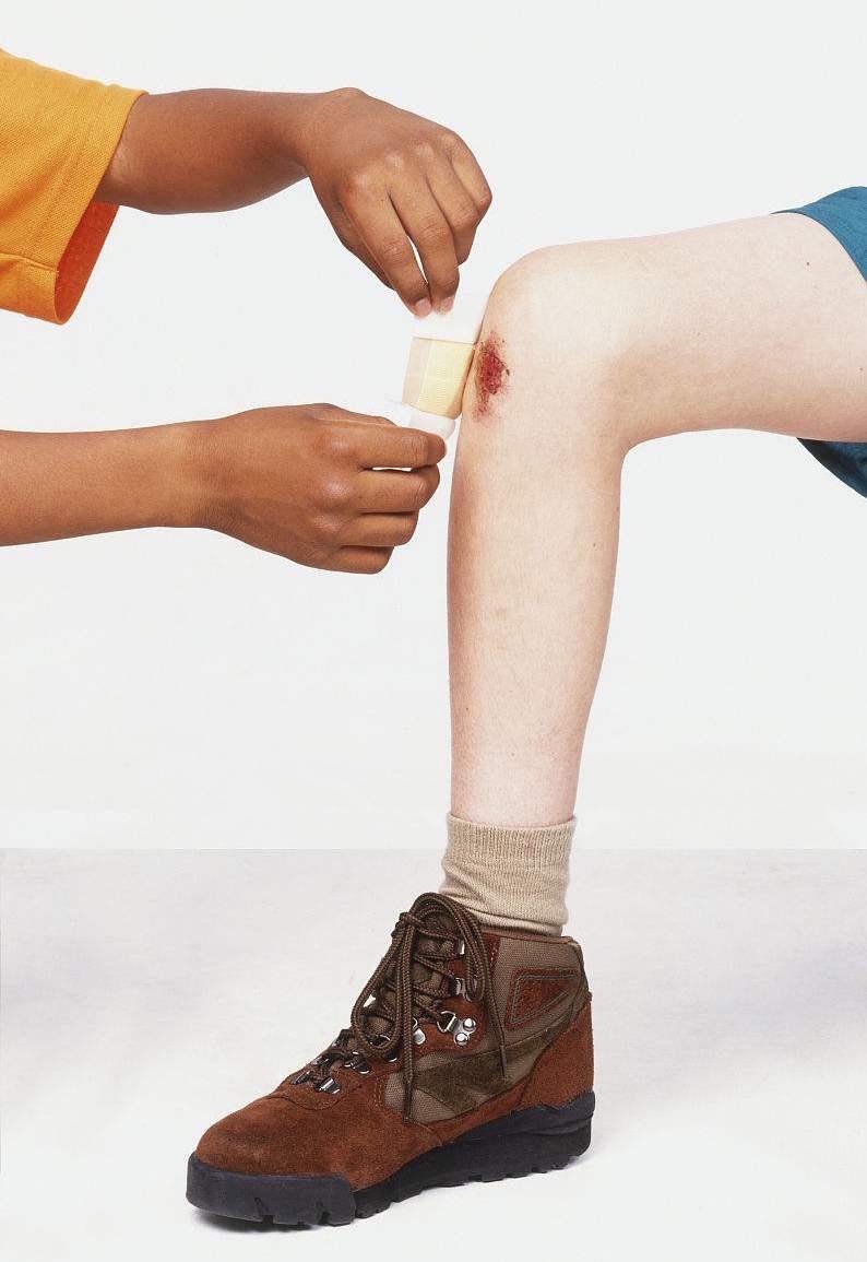 为什么运动擦伤时要用清水冲洗,而后伤口又不