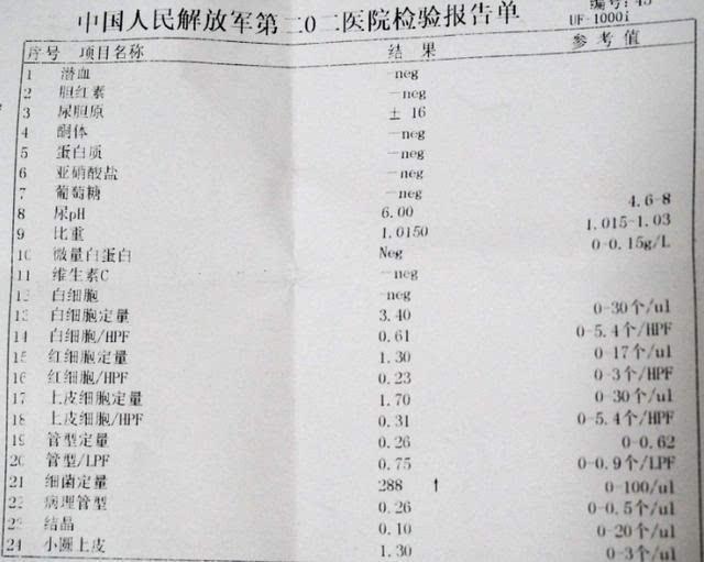 孕期必做的7个产检项目,有一项比较贵,比生孩