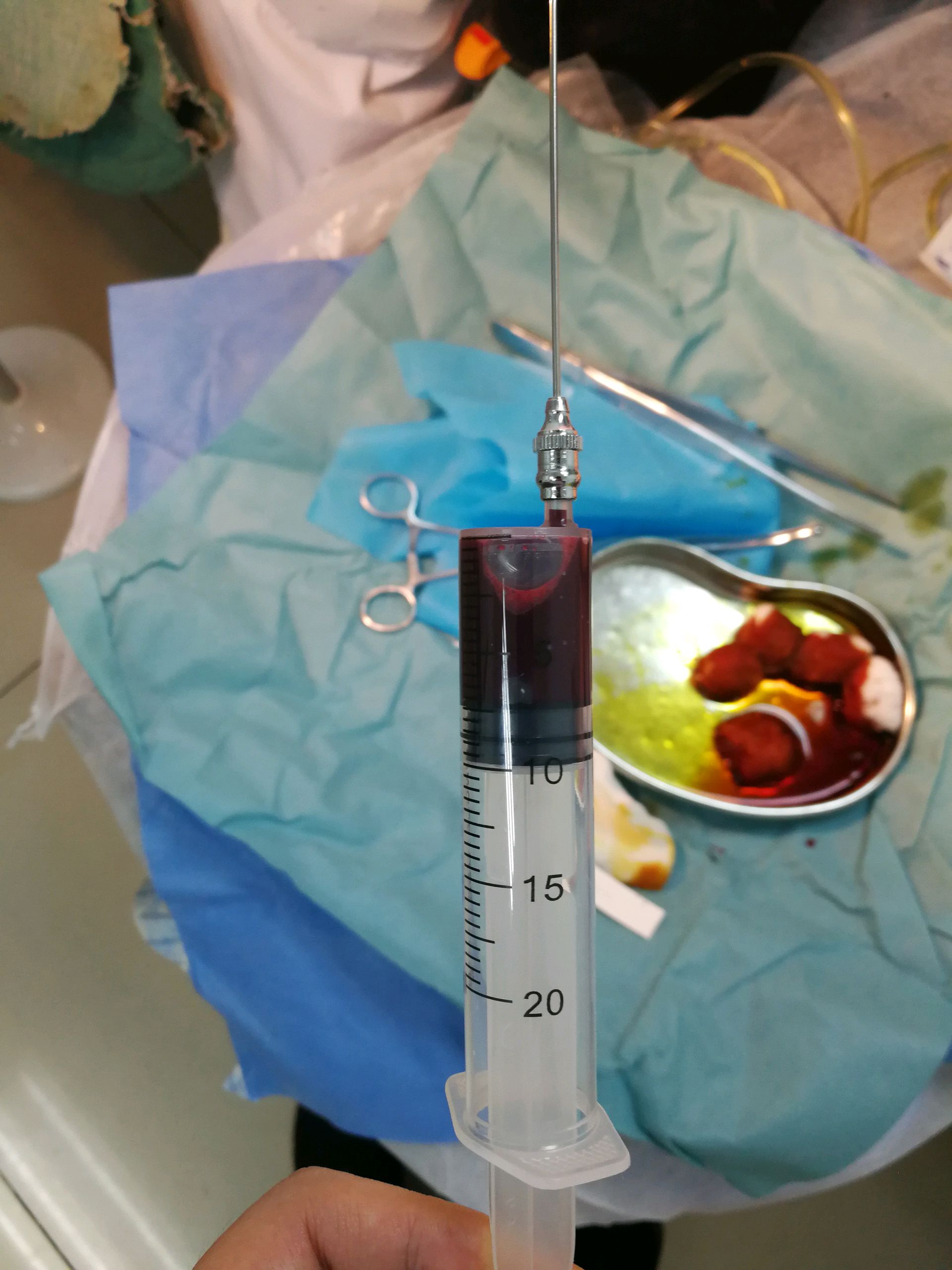 普外科与妇科的那些事