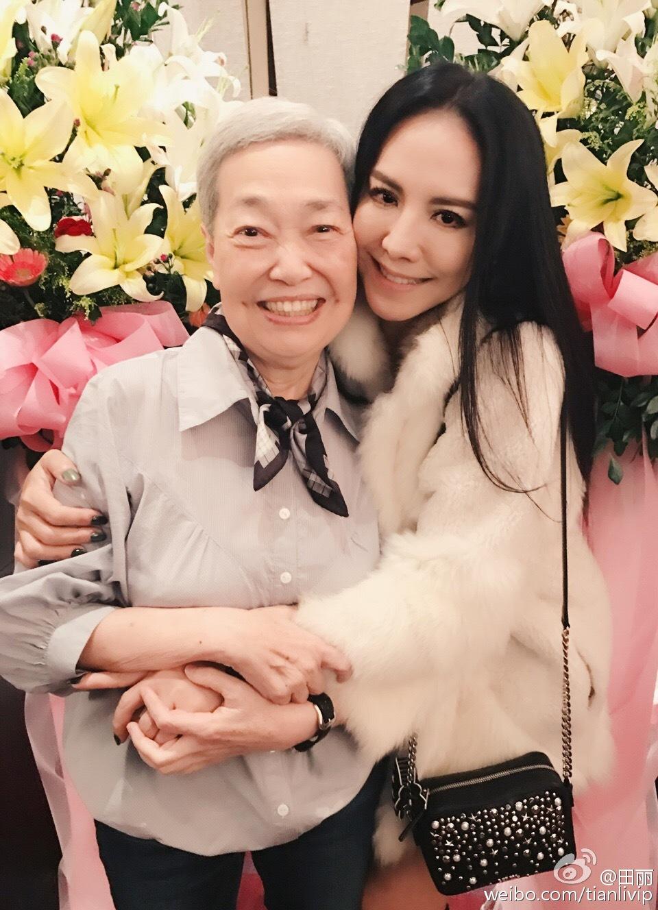 昔日英气小昭,为臀部投保5千万,和马景涛分手