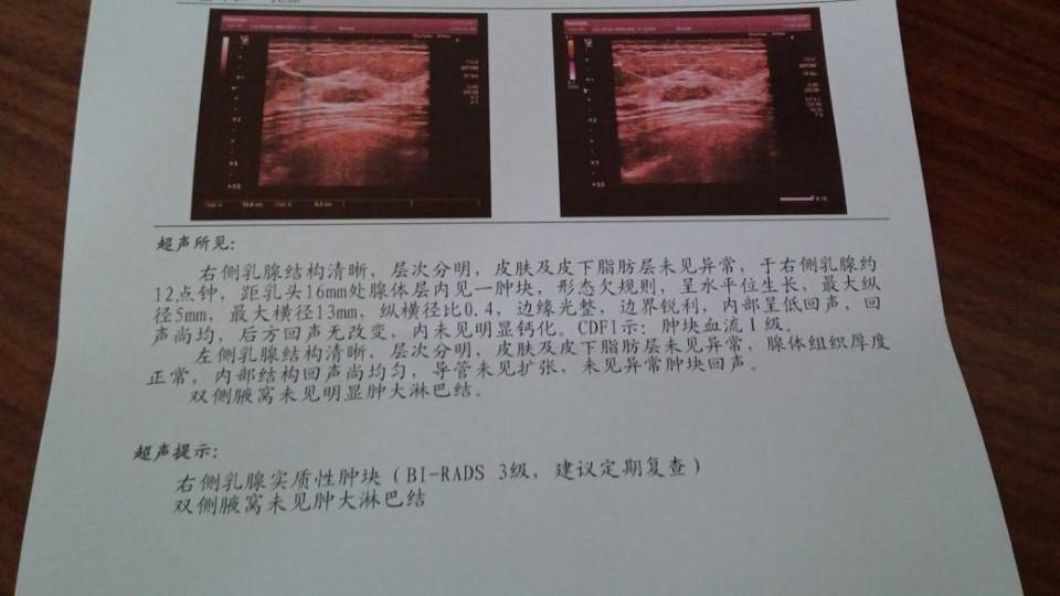 乳腺超声报告上的BI-RADS分级+乳腺自检