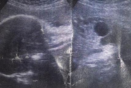 39岁孕妇二胎产女宝,当胎儿出生时,在场医生吓
