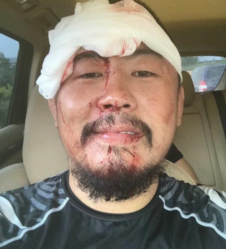 徐晓冬被打!为还原真实格斗,被拳手飞膝击中,额