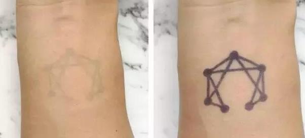 网红半永久纹身!超逼真、抗水洗,2周后自然退