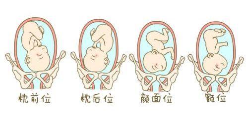 做好这4点,90%以上孕妈都可顺产!