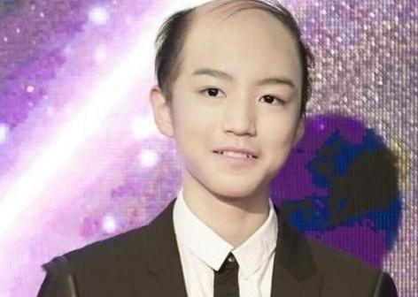 男星的颜值再高也撑不起地中海这个发型只有他毫无违和感
