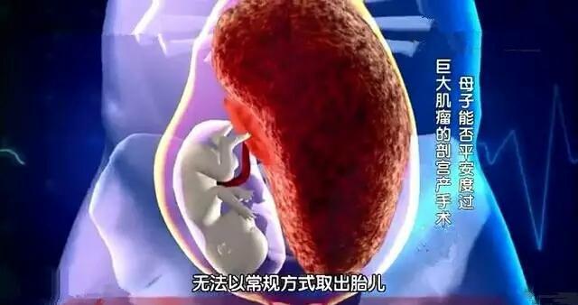 孕妇怀孕8个月突然羊水破了，医生划开肚子直冒