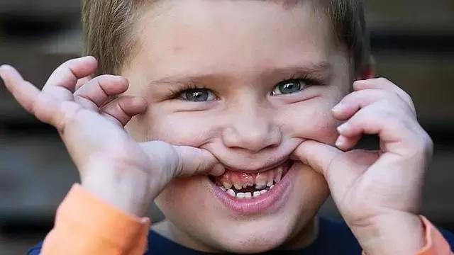 妈妈必知:千万别这样给孩子吃水果,尤其1岁以