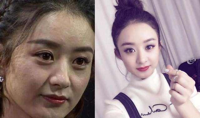 女星未修图:baby额头全是痘,赵丽颖皮肤差,刘诗诗太美了!
