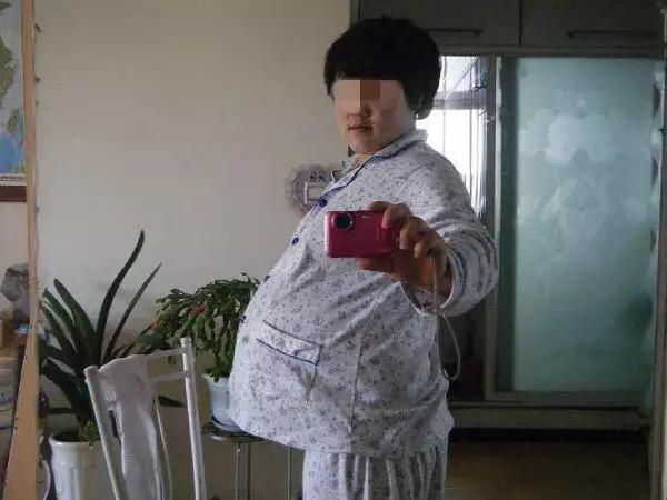 孕妇怀孕8个月突然羊水破了,医生划开肚子直冒