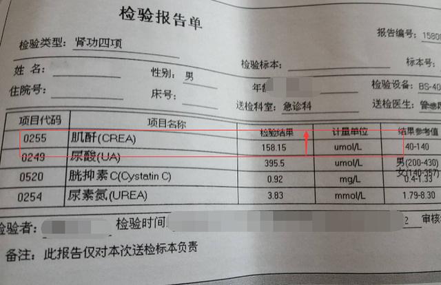 肌酐值高,先别慌!早上吃2勺这食物,肌酐值降、