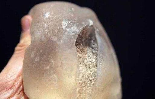 蒸完桑拿后女子发现身体不对劲,到医院检查后