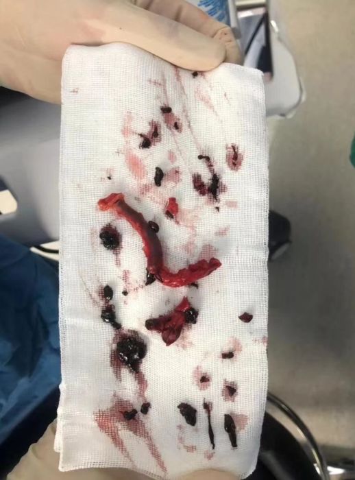 一个小动作,每天做一做,疏通血管,防血栓!