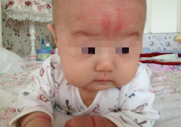 宝宝半夜突然大哭,宝妈哄好久才睡,第二天去医