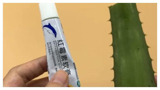 活了30年才知道,红霉素软膏抹鼻子上真厉害,可