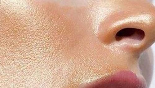 脸上挤出白色分泌物,网友表示:里面都是螨虫,2