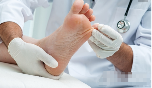 灰指甲必须拔甲吃药吗?不见得,中医一个偏方就