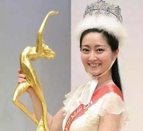 治愈女神新垣结衣也整容？word天，她整了哪里？