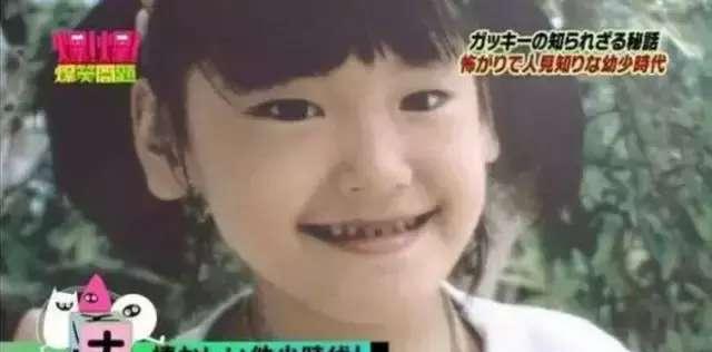 治愈女神新垣结衣也整容？word天，她整了哪里？