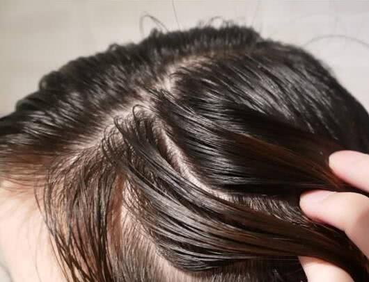 头上总感觉有虫子在爬? 是螨虫在跟你说嗨, 3方