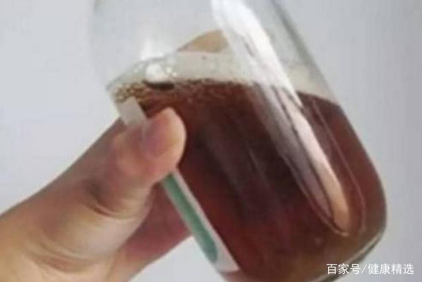 早上起床后没有这4个症状,恭喜你,说明你的肝