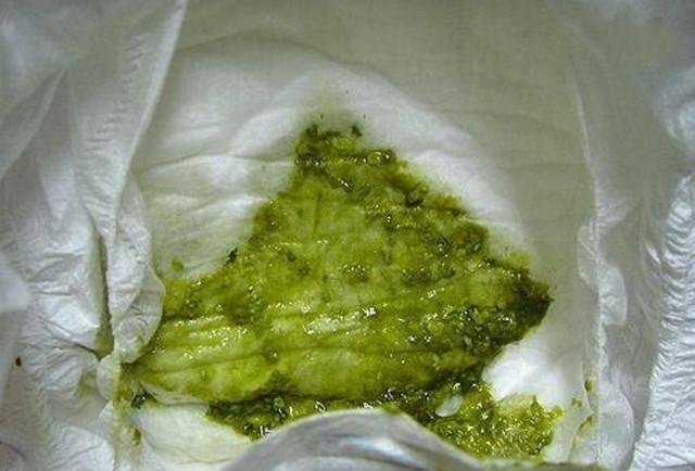 造成便便呈红色的原因有很多,比如吃了西红柿这类红色的食物,但如果是