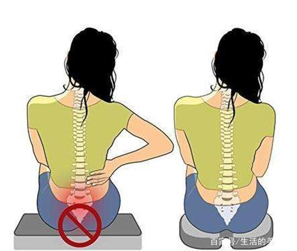 尾骨疼是怎么回事儿?坐久了?还是其它疾病的信号