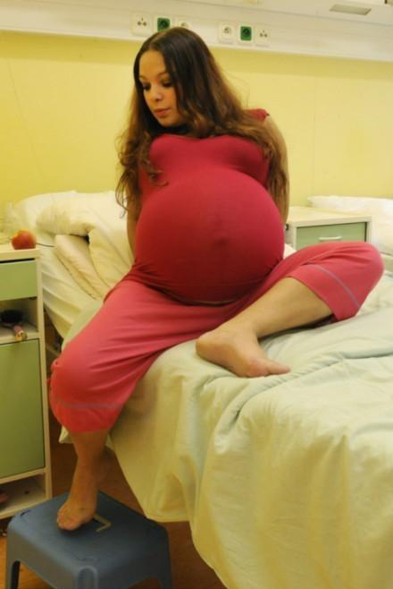 一孕妇肚子大的出奇,送医生产后,分娩数量医生看后都