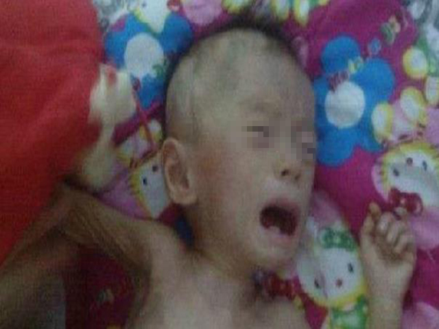 1岁宝宝严重营养不良,医生检查后告知原因,全