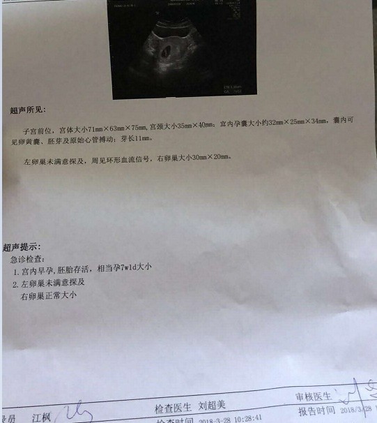 多囊、卵泡发育慢,终于怀上了,幸福来得太突然