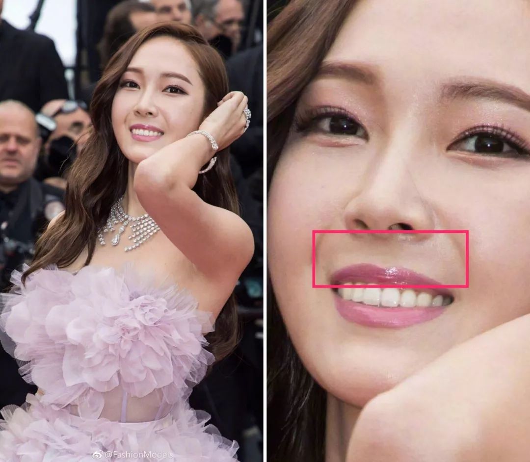 走近科学|奚梦瑶郑秀妍高清红毯照惊现假体?!